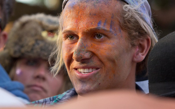 Jamie Laing Suffers Painful Side Effects After Running Five Ultra Marathons for Comic Relief